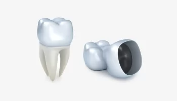 Dental Crowns in Aurora, CO: Everything You Need to Know